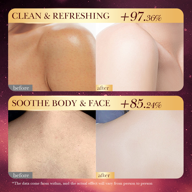 Rose Gold Foil Handmade Soap – - Luxury Skincare Essential ulasan dan harga