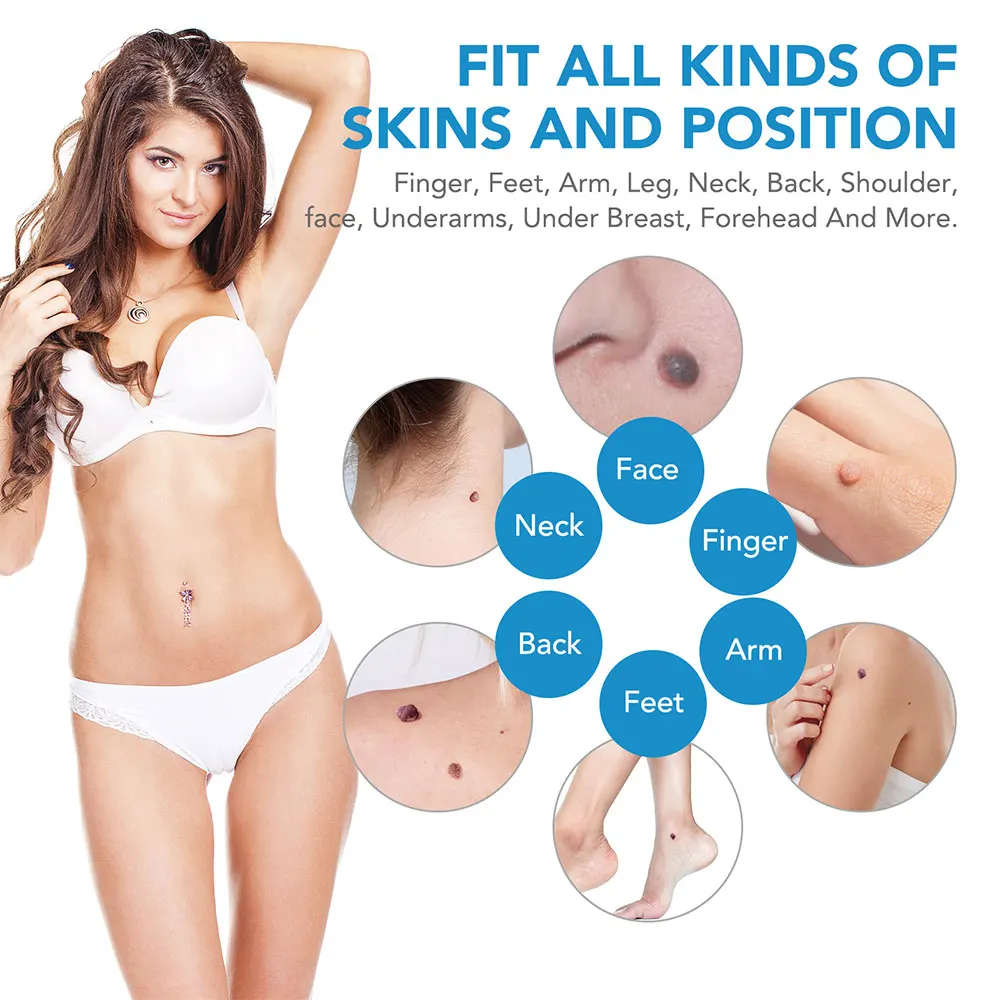 Auto Skin Tag Removal Tool Kit - Luxury Skincare Acne ulasan dan harga